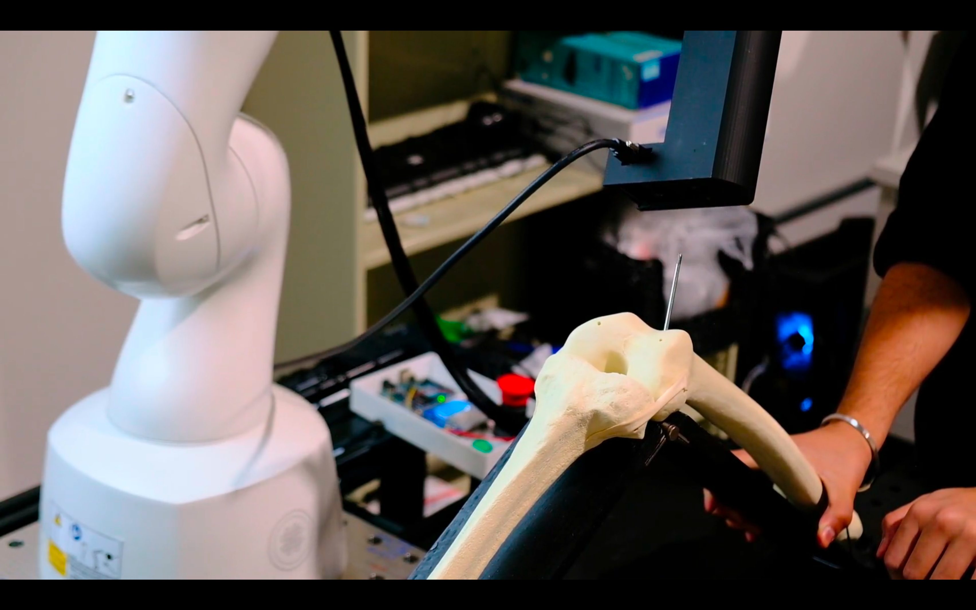 AR Knee Surgery Project
